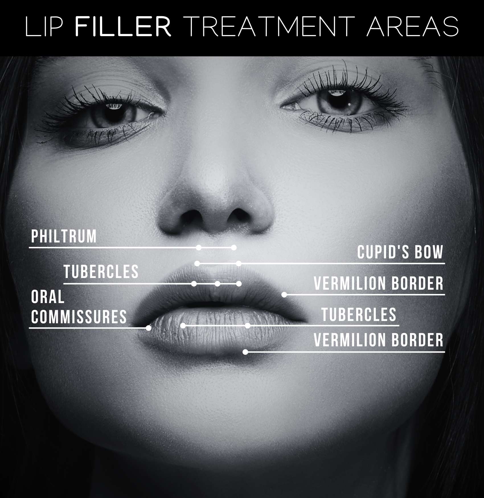 An image showing the anatomy of lips.