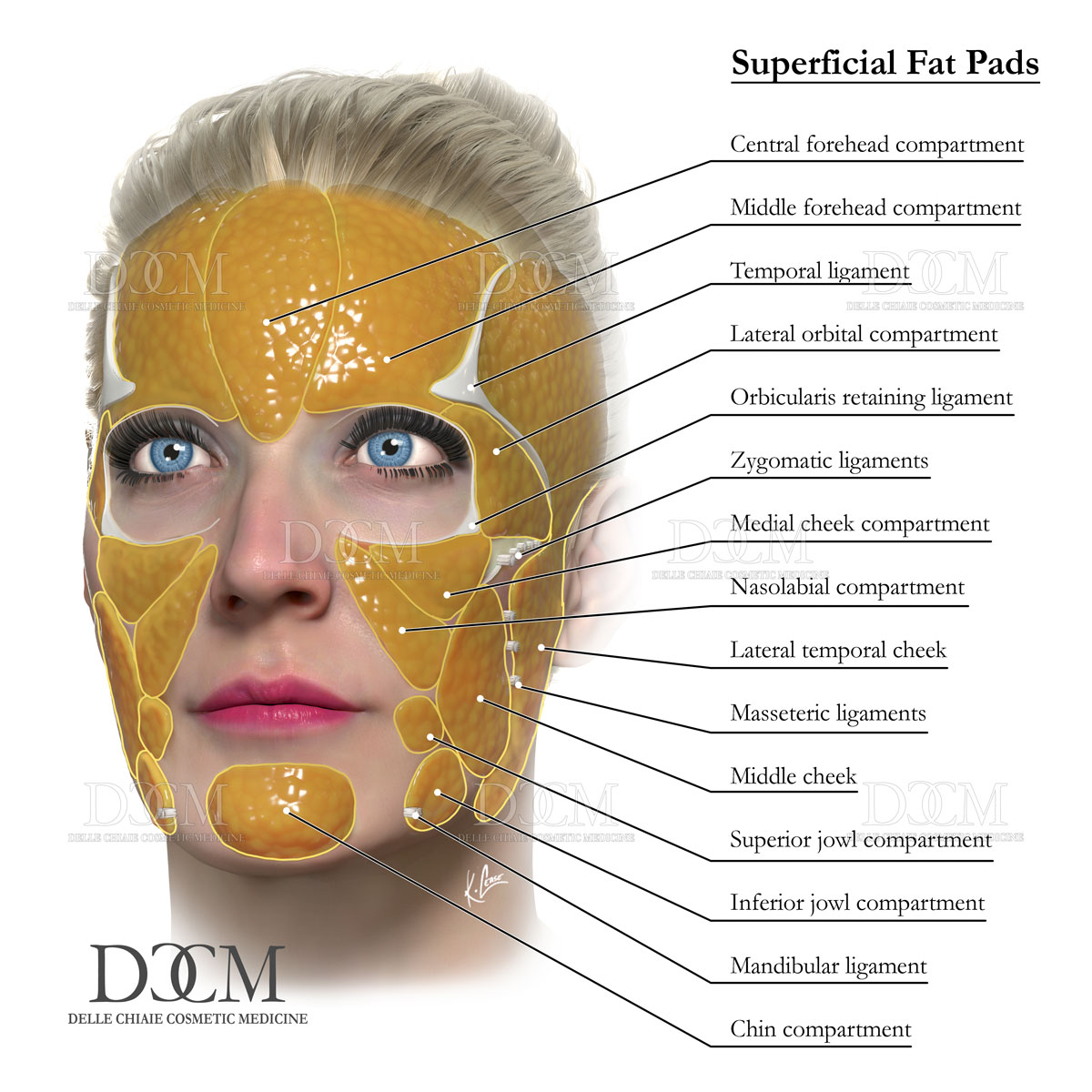 Superficial Fat Pads Poster - Image 2